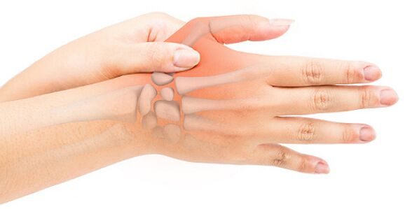 A szűkületes ligamentitis az ujjat hajlított helyzetbe zárja