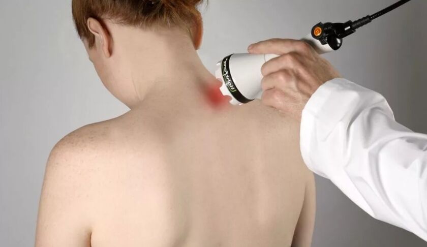 A méhnyak osteokondrózisának fizioterápiás módszere